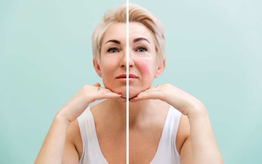 Lesser Known Treatments for Skin Conditions